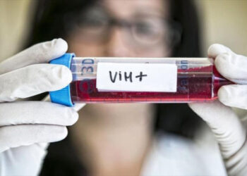 salud Alrededor de 4,000 casos positivos al VIH son reportados por año en el país
