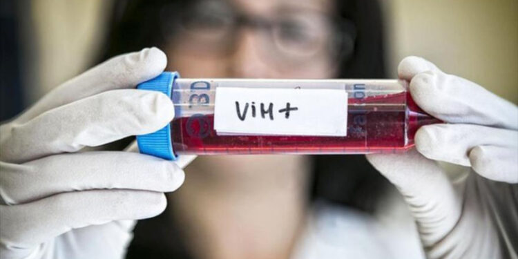 salud Alrededor de 4,000 casos positivos al VIH son reportados por año en el país